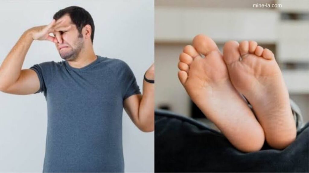 กำจัดเท้าเหม็น ส่วนใหญ่แล้ว การวินิจฉัยว่า มีเหงื่อออกที่เท้ามากเกินไปขึ้นอยู่กับอาการและการตรวจร่างกายของเท้า แพทย์ซึ่งแก้โรคเ