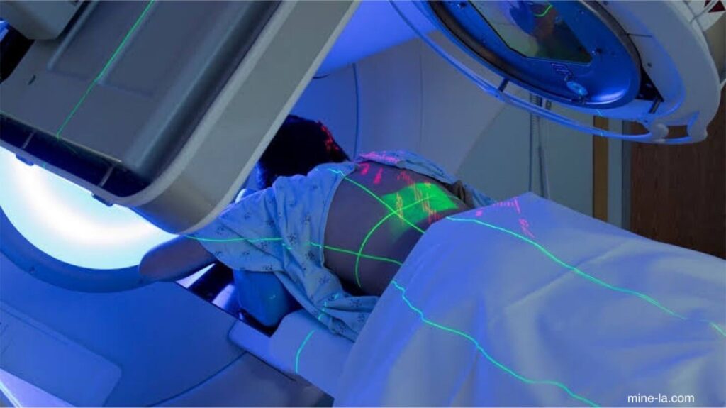 การผ่าตัดด้วยรังสี หรือที่เรียกว่า Stereotactic radiosurgery เป็นรูปแบบหนึ่งของรังสีวิทยาเพื่อการรักษาที่แม่นยำมาก แม้ว่าจะเรียกว่า