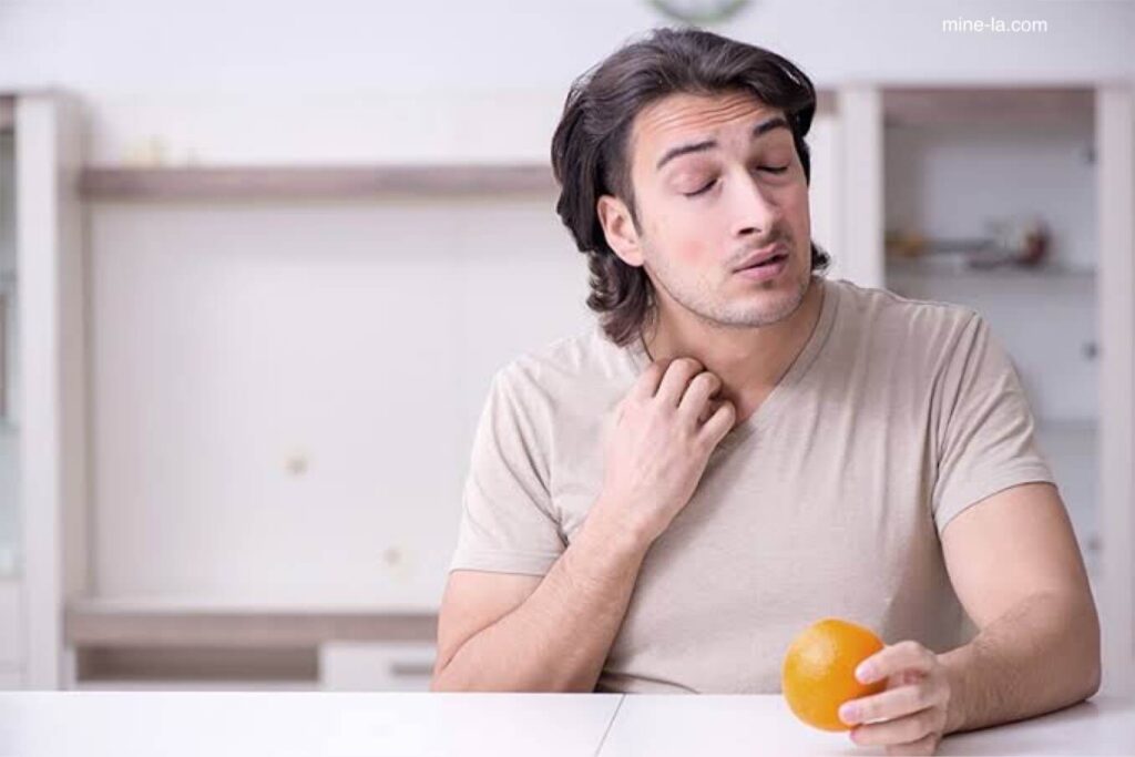 การแพ้ส้ม เป็นเรื่องแปลกแต่เป็นไปได้ มีรายงานการแพ้เกรฟฟรุตและส้ม ผู้ที่แพ้ผลไม้รสเปรี้ยวอาจมีอาการได้หลากหลาย อาจมีตั้งแต่อาการเ