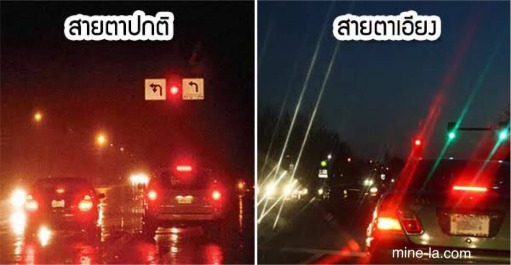 สายตาเอียง เป็นความไม่สมบูรณ์ทั่วไปที่รักษาได้ในส่วนโค้งของดวงตาที่ทำให้เกิดระยะพร่ามัวและการมองเห็นใกล้ สายตาเอียงเกิดขึ้นเมื่อ