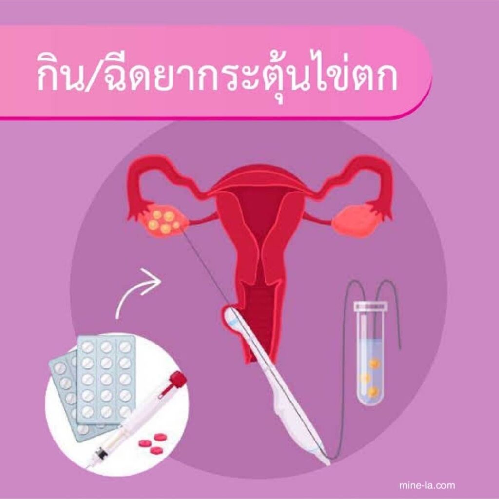 การกระตุ้นการตกไข่ จำเป็นในกรณี ผู้หญิงไม่สามารถตกไข่ได้ด้วยตัวเอง อาจจำเป็นต้องกระตุ้นการตกไข่ สาเหตุที่พบบ่อยที่สุดของความล้
