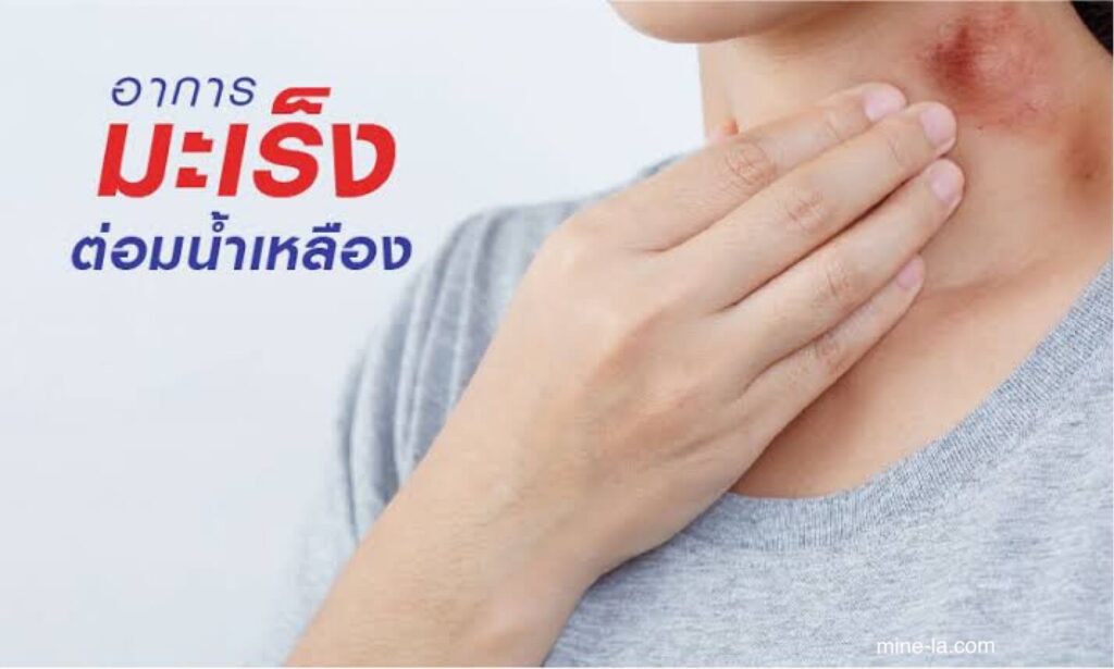 มะเร็งต่อมน้ำเหลือง ชนิดไม่รุนแรงส่วนใหญ่ถือเป็นโรคเรื้อรังที่แม้ว่าจะรักษาไม่หายก็สามารถรักษาได้ดีด้วยการเฝ้าดูและรอและการรักษาเป็นครั้งค